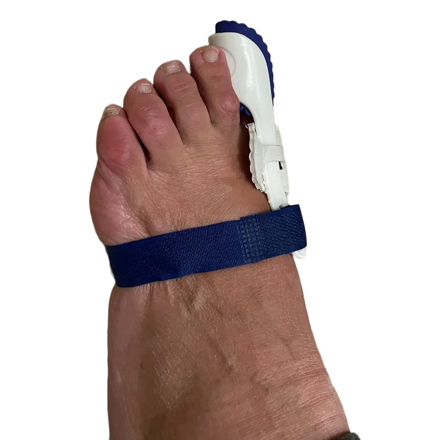 Hemmka Health Hallux Valgus Night Splint for Bunions