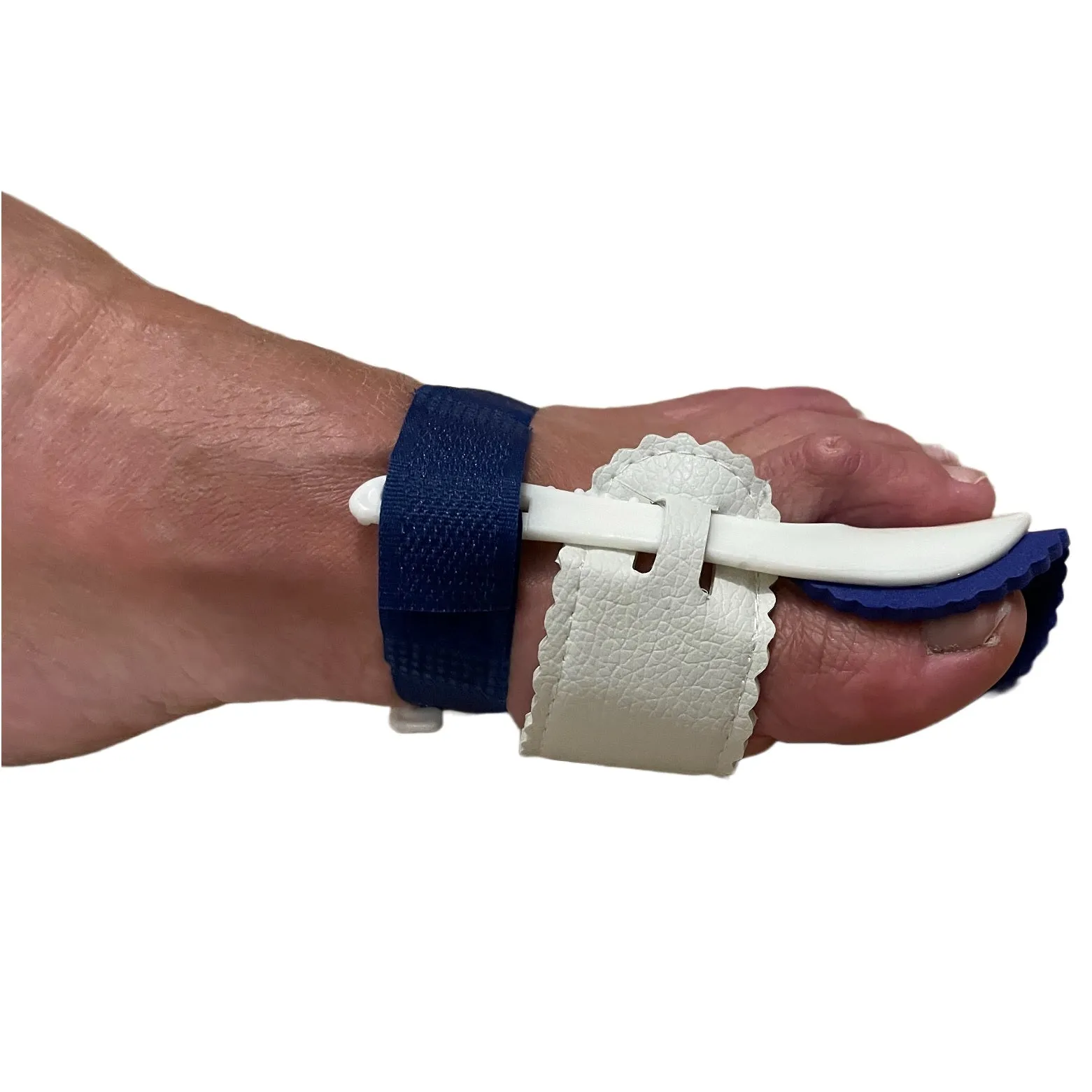 Hemmka Health Hallux Valgus Night Splint for Bunions