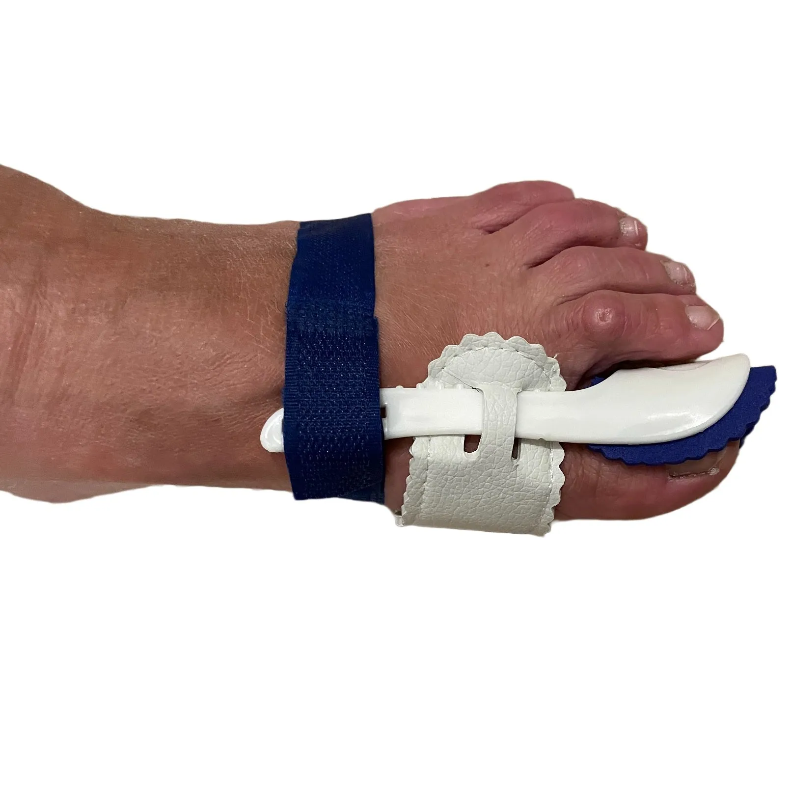 Hemmka Health Hallux Valgus Night Splint for Bunions